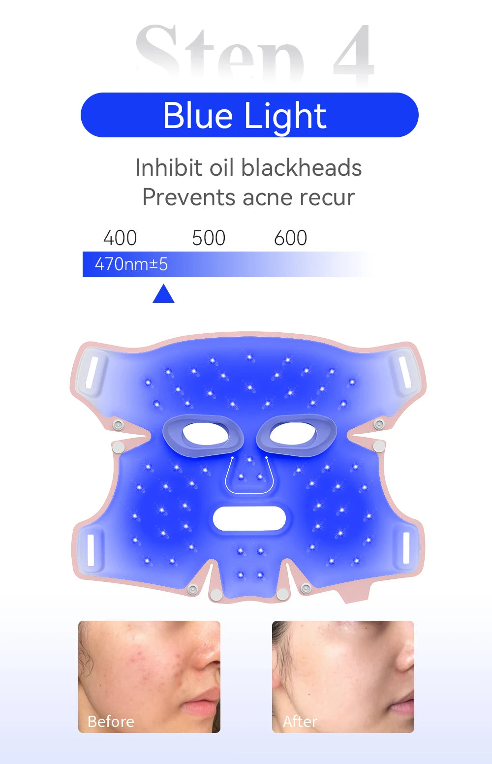 ANLAN Facial LED Mask – 5 Color LED Therapy