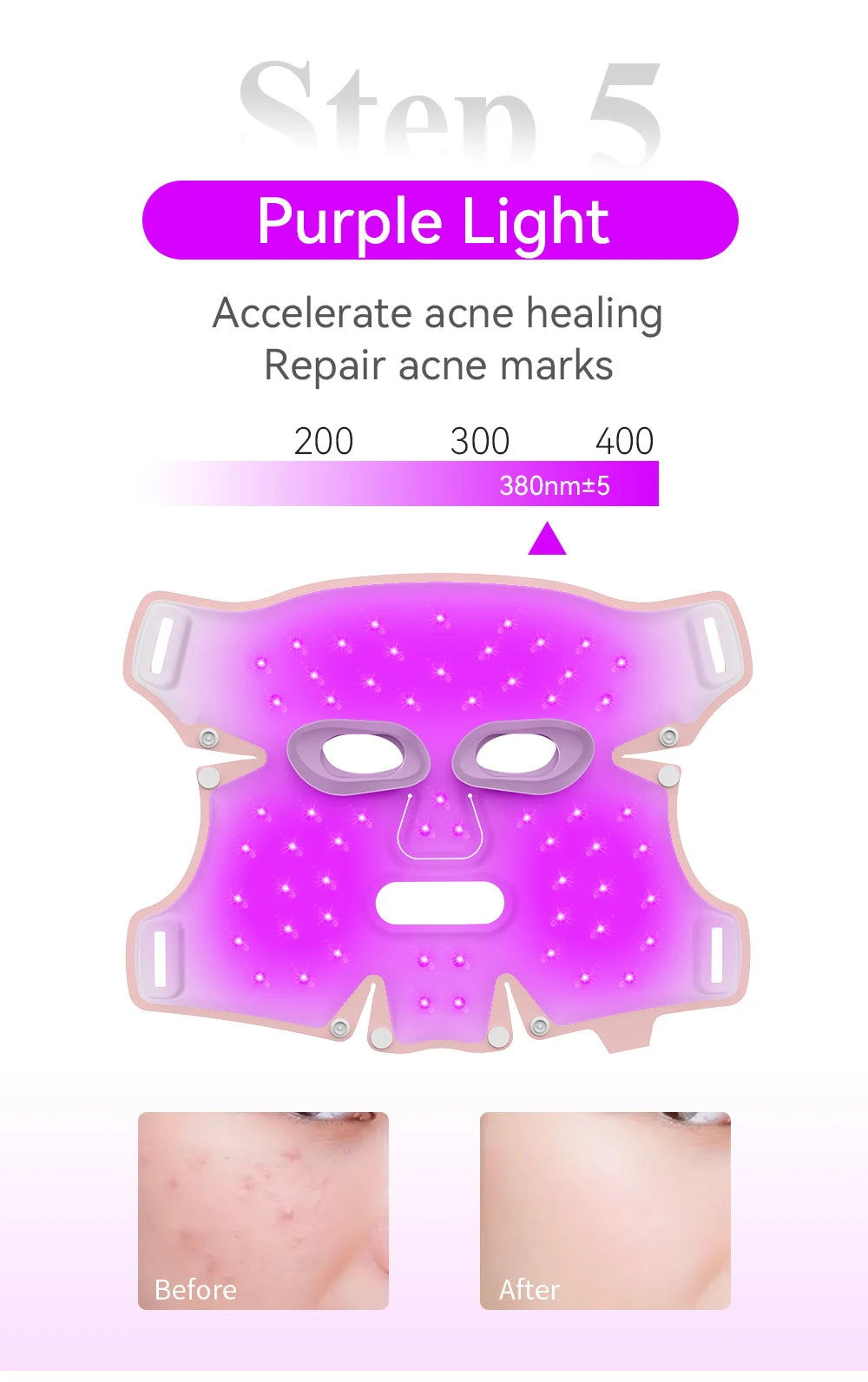 ANLAN Facial LED Mask – 5 Color LED Therapy